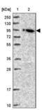 Oxysterol Binding Protein antibody, NBP2-47343, Novus Biologicals, Western Blot image 