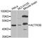 Actin Related Protein 3B antibody, A7824, ABclonal Technology, Western Blot image 