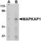 MAPK Associated Protein 1 antibody, TA306409, Origene, Western Blot image 