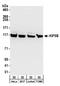 Kinesin Family Member 5B antibody, A304-306A, Bethyl Labs, Western Blot image 