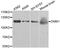 Dynamin 1 antibody, STJ23407, St John