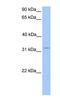 Potassium Channel Tetramerization Domain Containing 21 antibody, NBP1-79548, Novus Biologicals, Western Blot image 