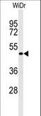 GATA Binding Protein 6 antibody, LS-C166385, Lifespan Biosciences, Western Blot image 