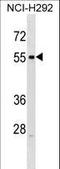 Relaxin-3 receptor 1 antibody, LS-C158911, Lifespan Biosciences, Western Blot image 