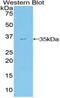 Autotaxin antibody, MBS2001947, MyBioSource, Western Blot image 