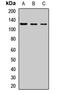 PK3CB antibody, LS-C667959, Lifespan Biosciences, Western Blot image 