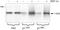 Protein Tyrosine Kinase 2 Beta antibody, GTX24800, GeneTex, Western Blot image 