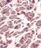 Sphingosine Kinase 1 antibody, 62-748, ProSci, Immunohistochemistry paraffin image 