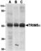 Tripartite motif-containing protein 5 antibody, MBS150100, MyBioSource, Western Blot image 