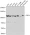 Tuftelin Interacting Protein 11 antibody, GTX65545, GeneTex, Western Blot image 
