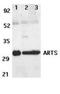 Septin-4 antibody, NBP1-76667, Novus Biologicals, Western Blot image 