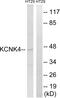 Potassium Two Pore Domain Channel Subfamily K Member 4 antibody, GTX87726, GeneTex, Western Blot image 