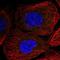 T-cell leukemia homeobox protein 2 antibody, NBP1-83973, Novus Biologicals, Immunocytochemistry image 