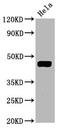 Mitogen-Activated Protein Kinase Kinase 1 antibody, CSB-RA013409A292phHU, Cusabio, Western Blot image 