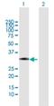 Zinc Finger CCHC-Type And RNA Binding Motif Containing 1 antibody, H00085437-B01P, Novus Biologicals, Western Blot image 