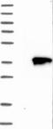 Tropomyosin 1 antibody, NBP1-89896, Novus Biologicals, Western Blot image 