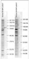 SH3 Domain Binding Protein 2 antibody, orb345428, Biorbyt, Western Blot image 