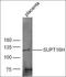 SPT16 Homolog, Facilitates Chromatin Remodeling Subunit antibody, orb101799, Biorbyt, Western Blot image 