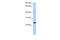 Egl-9 Family Hypoxia Inducible Factor 3 antibody, 30-813, ProSci, Enzyme Linked Immunosorbent Assay image 