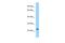 Transmembrane Protein 114 antibody, A14591, Boster Biological Technology, Western Blot image 