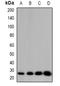 Cell Death Inducing DFFA Like Effector B antibody, orb382531, Biorbyt, Western Blot image 