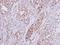 Ribosomal Protein S10 antibody, NBP1-31357, Novus Biologicals, Immunohistochemistry frozen image 