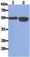 Keratin 14 antibody, GTX57611, GeneTex, Western Blot image 