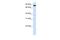 Acyl-CoA Synthetase Long Chain Family Member 3 antibody, PA5-42883, Invitrogen Antibodies, Western Blot image 