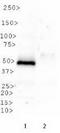 Lysine Methyltransferase 5A antibody, TA309852, Origene, Western Blot image 