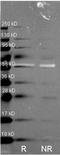 Catalase antibody, orb344573, Biorbyt, Western Blot image 