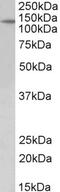 MAPK Activated Protein Kinase 2 antibody, 43-313, ProSci, Western Blot image 