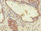 Zinc Finger Protein 844 antibody, LS-C394473, Lifespan Biosciences, Immunohistochemistry paraffin image 