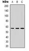 Dyskerin Pseudouridine Synthase 1 antibody, LS-C368647, Lifespan Biosciences, Western Blot image 