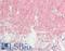 IgG1 antibody, LS-B14157, Lifespan Biosciences, Immunohistochemistry paraffin image 