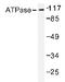 ATPase Na+/K+ Transporting Subunit Alpha 1 antibody, AP20203PU-N, Origene, Western Blot image 