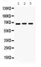 Potassium Voltage-Gated Channel Subfamily A Member 5 antibody, PB9651, Boster Biological Technology, Western Blot image 