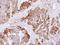 Cystathionine-Beta-Synthase antibody, NBP1-33518, Novus Biologicals, Immunohistochemistry paraffin image 