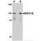 Zinc Finger FYVE-Type Containing 26 antibody, MBS150880, MyBioSource, Western Blot image 