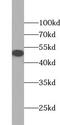 TSPY Like 1 antibody, FNab09068, FineTest, Western Blot image 