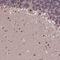 Ubiquitin Protein Ligase E3A antibody, NBP1-89092, Novus Biologicals, Immunohistochemistry paraffin image 