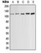 Protein Kinase D1 antibody, LS-C352718, Lifespan Biosciences, Western Blot image 