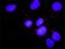 Protein Kinase, Membrane Associated Tyrosine/Threonine 1 antibody, H00009088-M03, Novus Biologicals, Proximity Ligation Assay image 