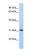 Synaptogyrin 4 antibody, orb330496, Biorbyt, Western Blot image 