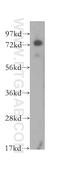 Interleukin 17 Receptor E antibody, 11984-1-AP, Proteintech Group, Western Blot image 