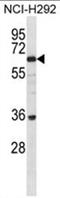 BTB Domain Containing 16 antibody, AP50401PU-N, Origene, Western Blot image 