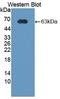 Corticotropin Releasing Hormone Binding Protein antibody, LS-C372954, Lifespan Biosciences, Western Blot image 