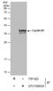 Cyclin D1 antibody, GTX108624, GeneTex, Immunoprecipitation image 