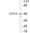 Cytochrome C Oxidase Assembly Factor Heme A:Farnesyltransferase COX10 antibody, LS-C199819, Lifespan Biosciences, Western Blot image 