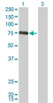 Colony Stimulating Factor 1 antibody, LS-C196978, Lifespan Biosciences, Western Blot image 