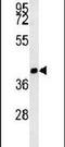 ST8 Alpha-N-Acetyl-Neuraminide Alpha-2,8-Sialyltransferase 3 antibody, PA5-25508, Invitrogen Antibodies, Western Blot image 